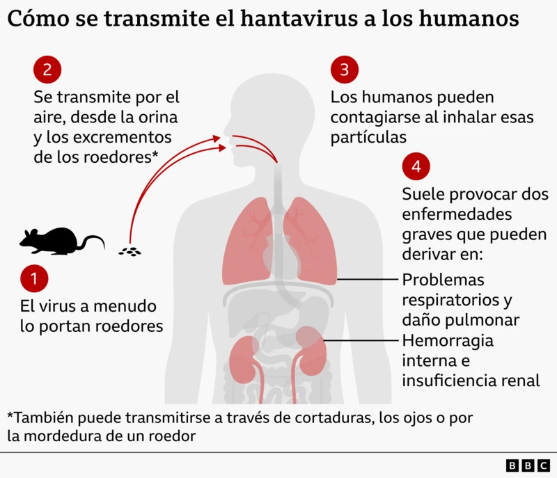 Hantavirus: cómo se transmite y qué señales no deberías ignorar 2 Hantavirus: cómo se transmite y qué señales no deberías ignorar
