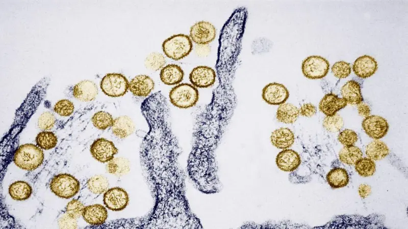 Hantavirus: cómo se transmite y qué señales no deberías ignorar 3 Hantavirus: cómo se transmite y qué señales no deberías ignorar