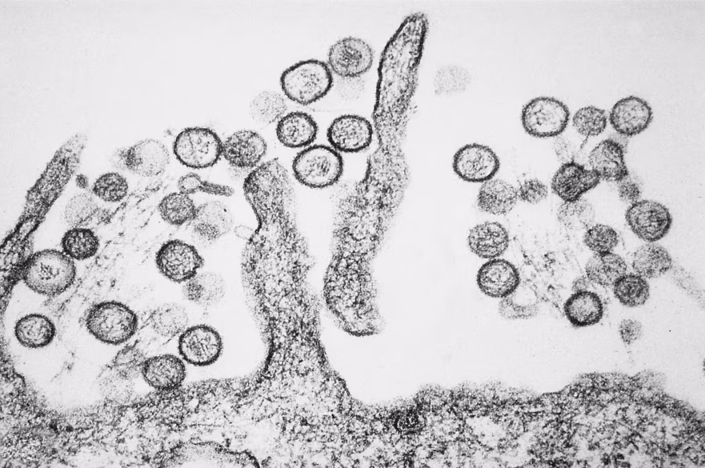 Hantavirus: cómo se transmite y qué señales no deberías ignorar 1 Hantavirus: cómo se transmite y qué señales no deberías ignorar