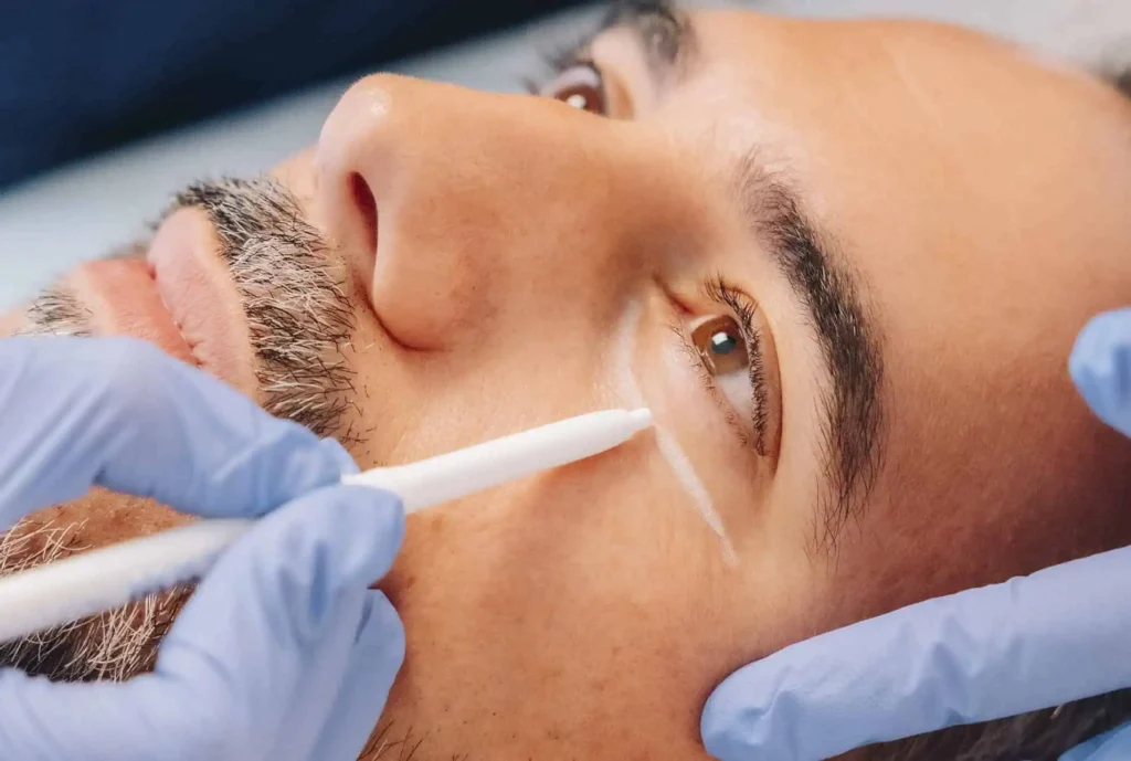 Ojeras: por qué algunas personas las tienen incluso descansando 2 Ojeras: por qué algunas personas las tienen incluso descansando
